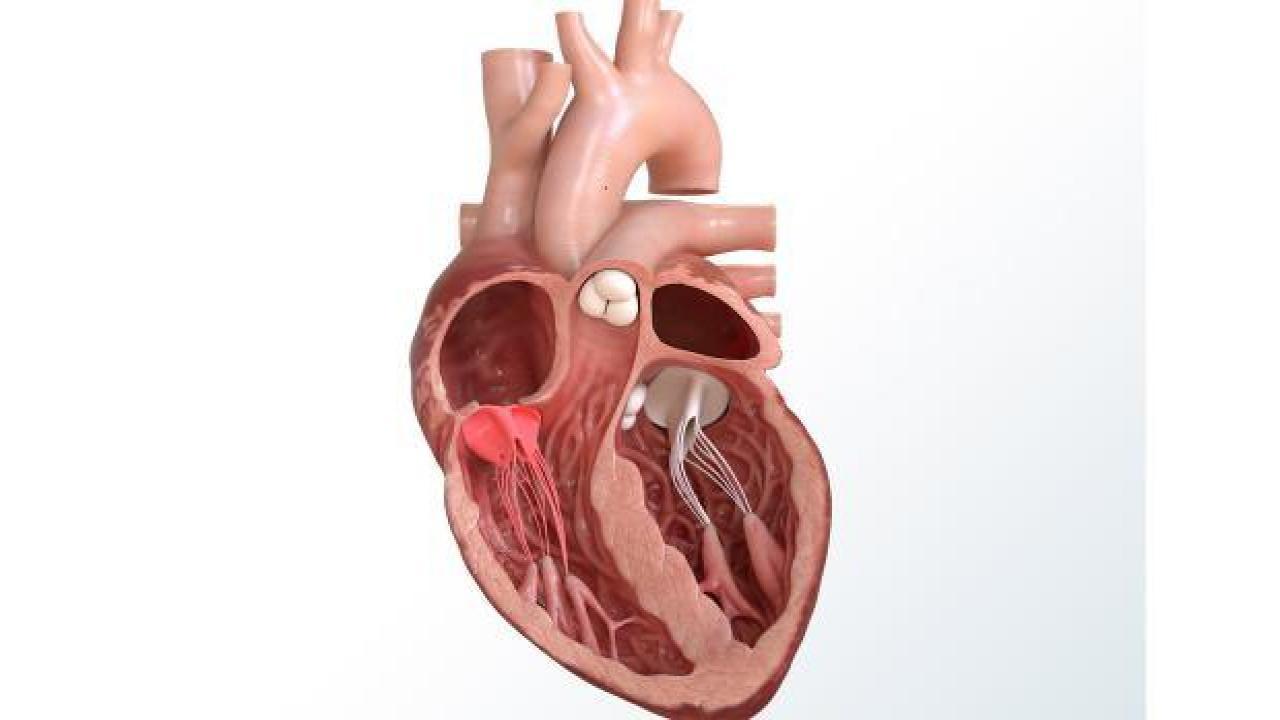 Kalp kapak tedavisinde ameliyatsız yöntemler! Kalp kapak hastalığının tedavisi...