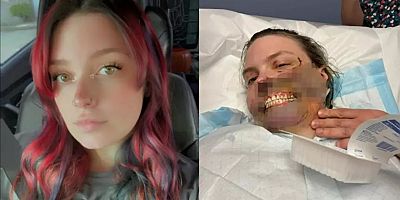 Nöbet Geçirirken Köpeğinin Saldırısına Uğradı